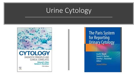 Urine cytology - Diagnostic Principles and Reporting.pptx