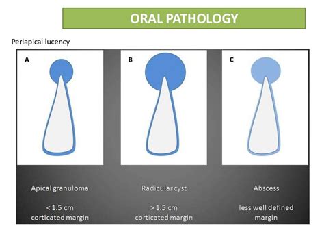 Radicular cyst or Periapical cyst