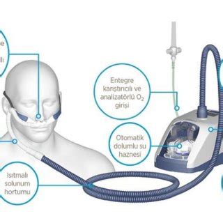 PDF YÜKSEK AKIMLI NAZAL OKSİJEN TEDAVİSİ HİPOKSEMİK SOLUNUM