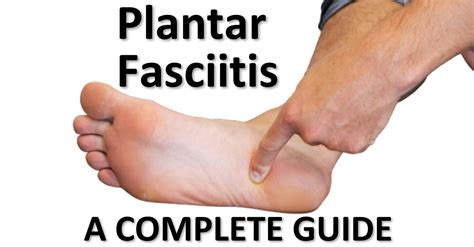 Plantar Fasciitis Our Complete Guide Cornerstone Physiotherapy