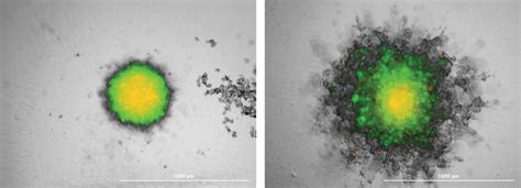 Considerations For 3D Spheroid Formation And Imaging