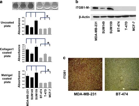 Analysis of cell adhesion and integrin β1 expression in breast cancer ... 