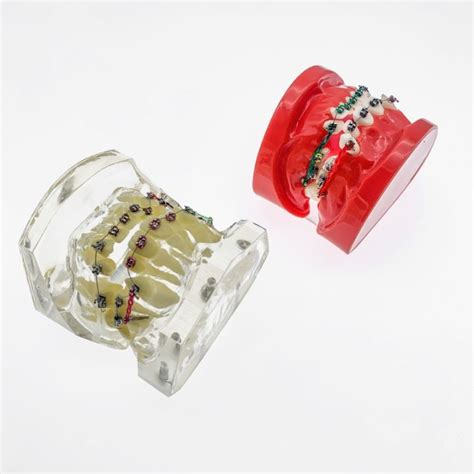 Dental Orthodontic Malocclusion Orthodontic Model With Colorful