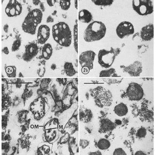 Sections through isolated mitochondria from aerobically grown cells ... 