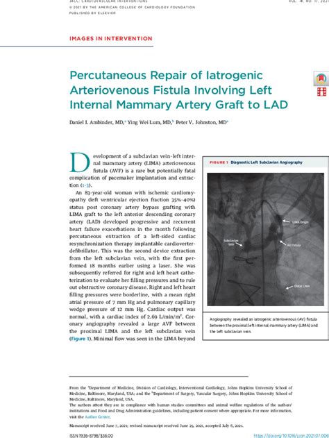 Percutaneous Repair Of Iatrogenic Arteriovenous Fistula Involving Left