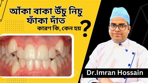 দত আক বক কন হয Cause of Malocclusion Dr Imran Hossain