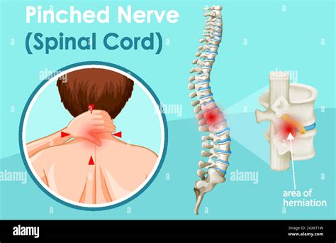 Diagram Showing Spinal Cord Stock Vector Image Art Alamy