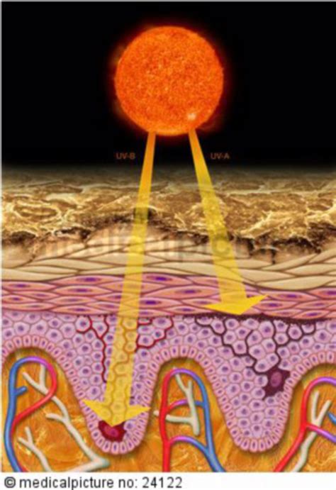 UV-Licht, Sonn und Epidermis - DocCheck