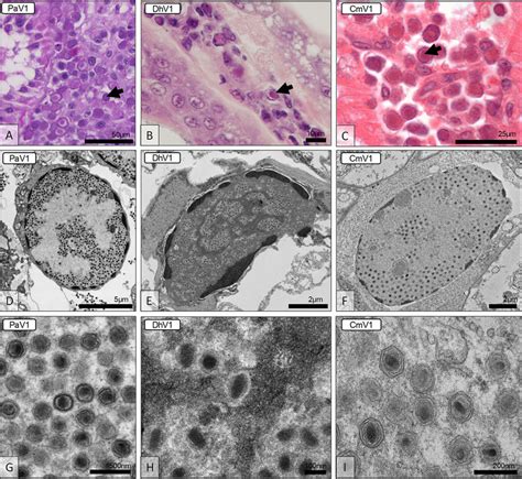 Histological And Ultrastructural Micrographs Of The Viruses In