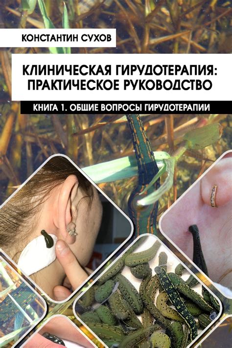 Клиническая гирудотерапия: практическое руководство | Магазин Неформат