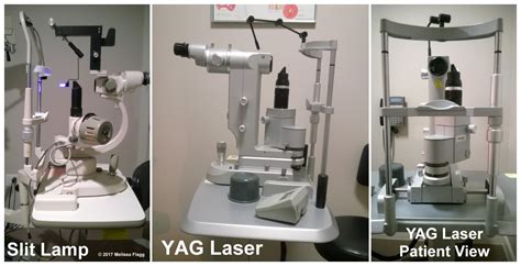 Definition Of Yag Laser Posterior Capsulotomy Healthproadvice