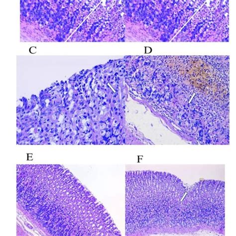 Microscopic Appearance Of Gastric Mucosa In A Rat Model Of