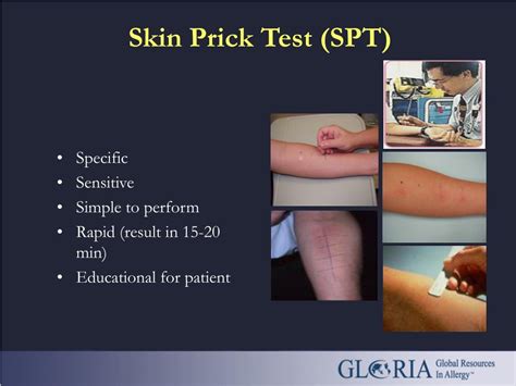 Ppt Gloria Module 11 Drug Allergy Part 2 Clinical Management Of