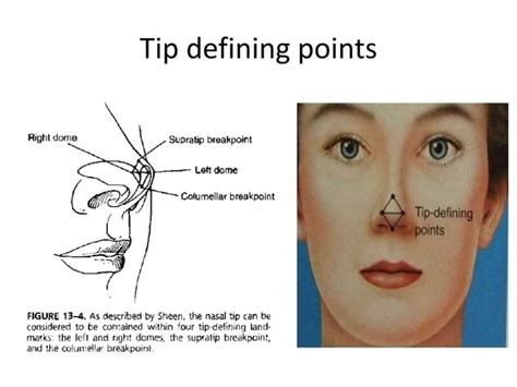 Surgical Anatomy Of Nose Mah Ppt