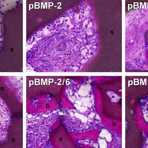 Tissue Ingrowth And Bone Formation After And Weeks In Vivo Images