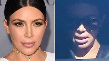 [PIC] Kim Kardashian Lip Fillers — Did She Get Any While Pregnant ...