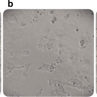 Cell morphology of SH-SY5Y cells (a). SH-SY5Y cells subjected to Aβ1–42 ...