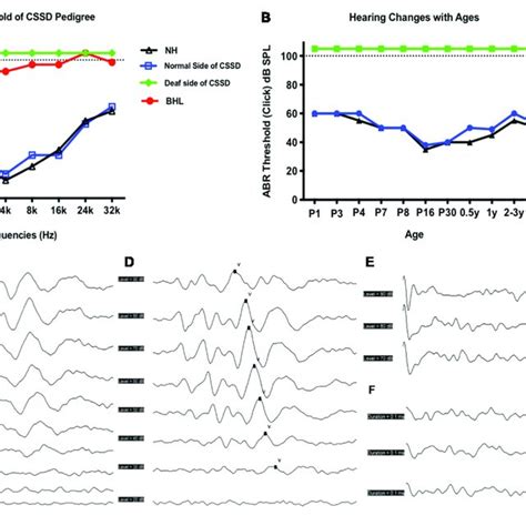 Auditory Brainstem Response Abr Hearing Thresholds Of Congenital Download Scientific