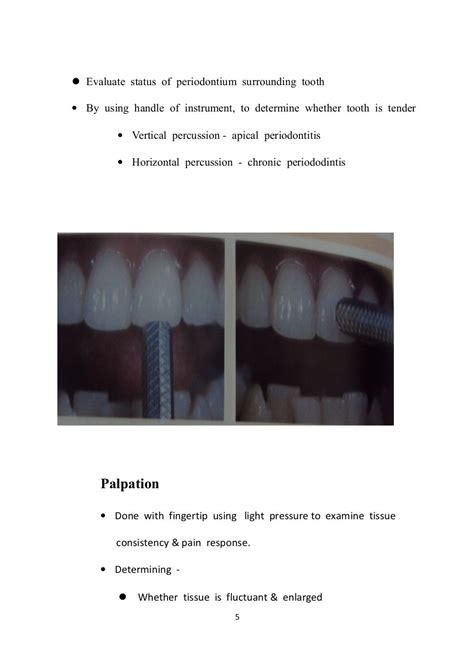 Seminar On Pulp Vitality Test