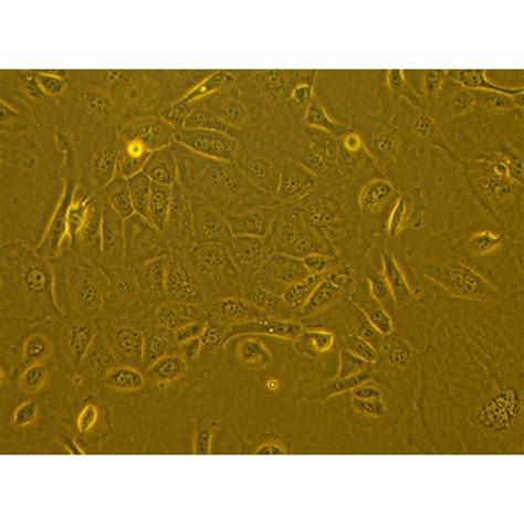 Human Primary Mammary Epithelial Cells