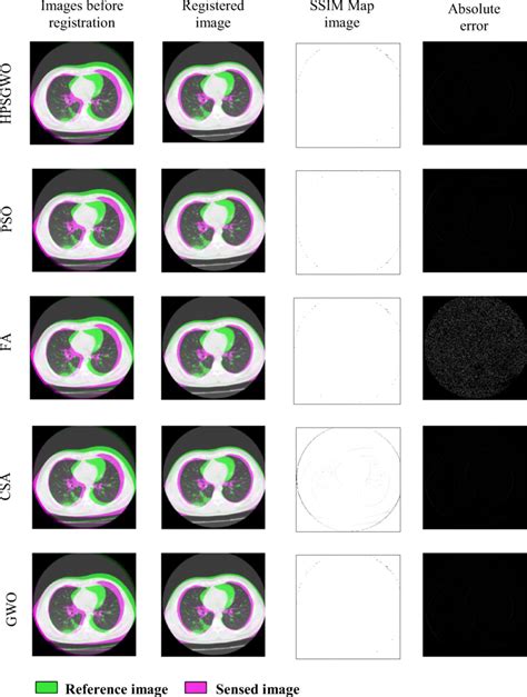 Visual Results Obtained From Multi Modal Image Registration Of Pair