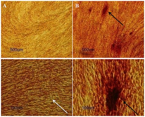 Frontiers Stem Cells From The Apical Papilla SCAP As A Tool For