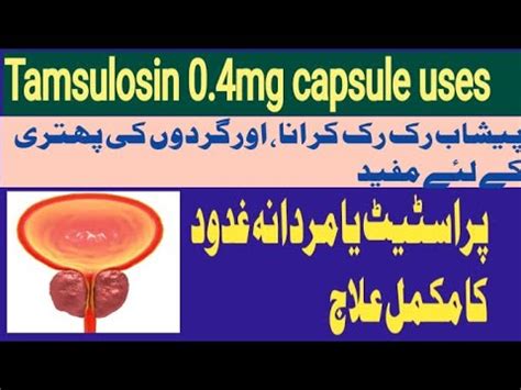 Tamsulosin Hcl Mg Capsule Uses Prostate Gland Enlargement