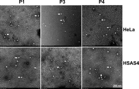 Transmission electron microscopy (TEM) ultrastructural analysis. PCV2 ... 