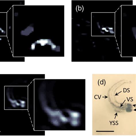 Four Different Ultrasound Views Of The Heart Clockwise From Upper