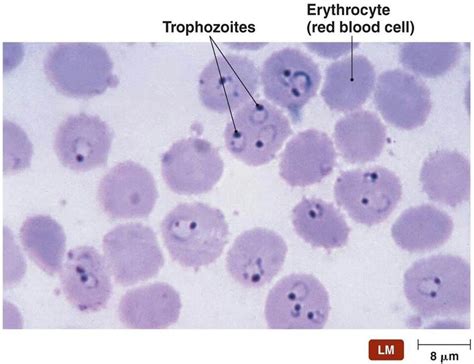 Plasmodium Under Microscope Labeled