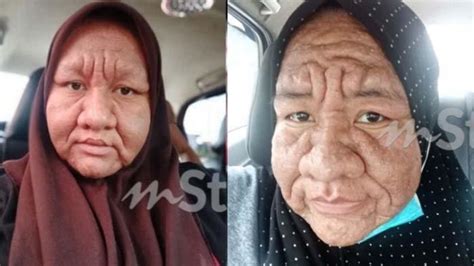 Dulu Bersimpati Pada Ibu Hamil Yang Wajahnya Berubah Tua Kini Wanita