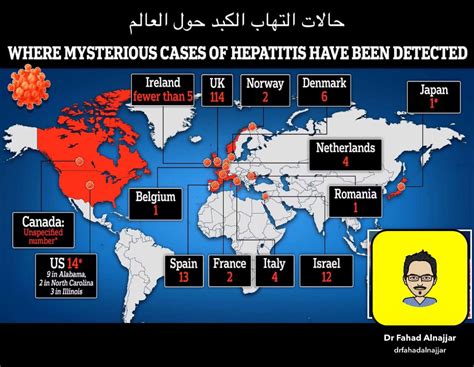 1️⃣خلاصة مانعرفه اليوم عن التهاب الكبد الذي حذرت منه منظمة الصحة