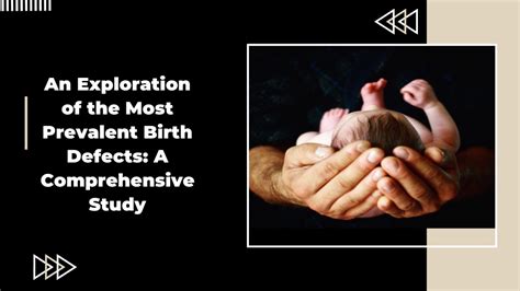 Ppt An Exploration Of The Most Prevalent Birth Defects A