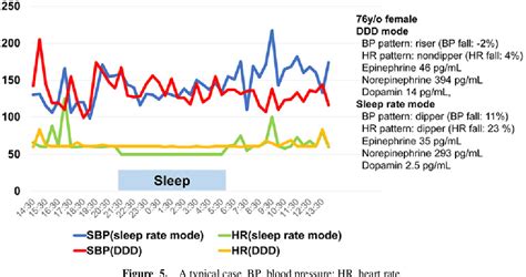 Sleep Rate Mode Of Pacemaker Dependent Patients With Sick Sinus