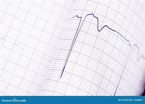 Folded Graph Paper With Ecg Stock Photo Image Of Medical Human 67225744