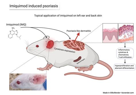 The Imiquimod Induced Skin Inflammation Model Of Psoriasis Ps In Mice