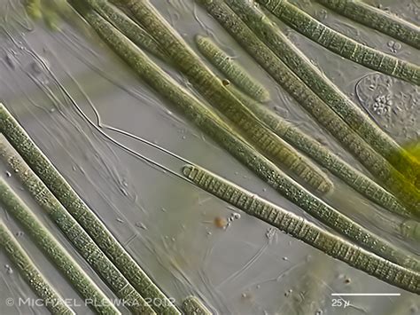 Freshwater and other micro-organisms from Germany: Phormidium sp. - a Cyanobacterium with an ...