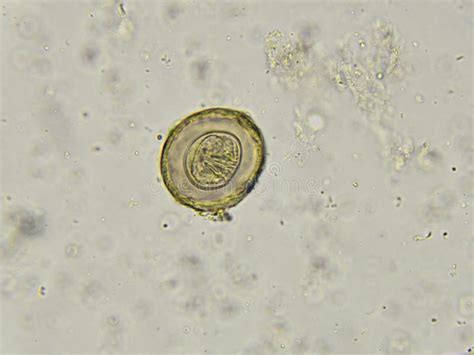 Hymenolepis Diminuta (tapeworm) Stock Photo - Image of infection ...