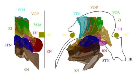 A three-dimensional atlas of the subthalamic nucleus and its adjacent ...