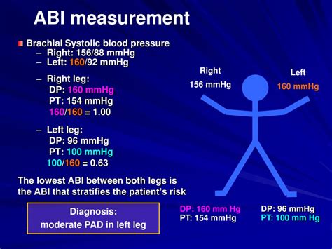 Ppt Ankle Brachial Index Measurement What Is It And Why Measure It