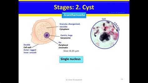 Acanthamoeba Cyst Morphology