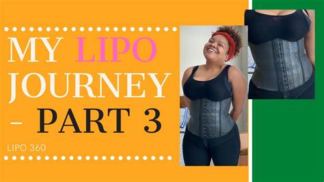 My Liposuction Journey Lipo Part How Much Was It Youtube