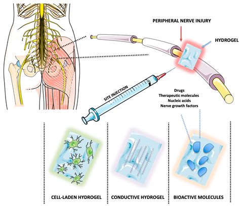 Hydrogels for Peripheral Nerve Repair: Emerging Materials and