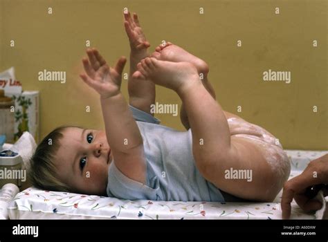 Onguent d éruption de bébé appliquée à l enfant en bas Photo Stock Alamy