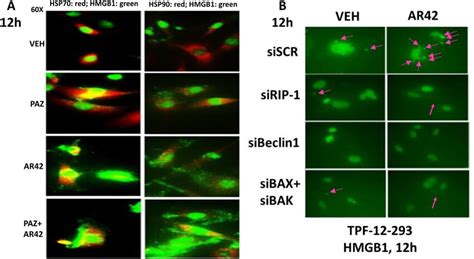 AR42 Promotes The Extracellular Release Of HMGB1 And HSP70 From