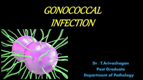 Gonococcal infection | PPT