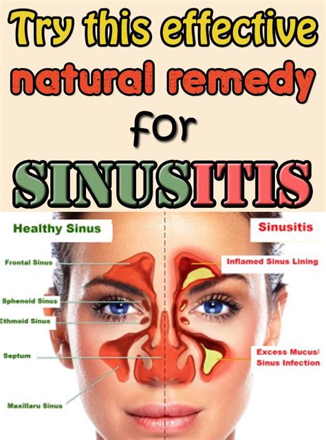 Try This Effective Natural Remedy For Sinusitis