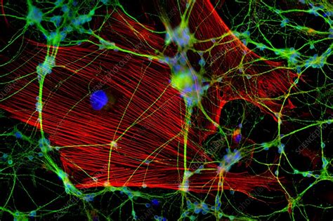 Glial cells, fluorescent micrograph - Stock Image - C008/8377 - Science ... 