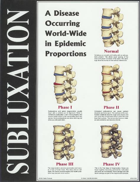 The Phases Of Subluxation Subluxation Chiropractic Care Upper