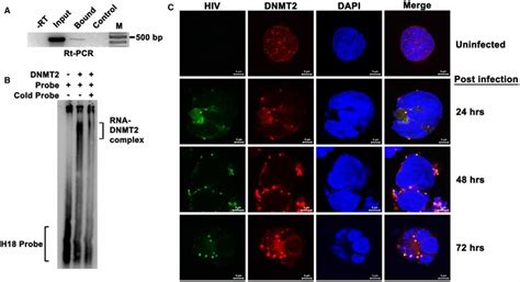 DNMT2 Binds To And Co Localizes With HIV 1 RNA During Infection A